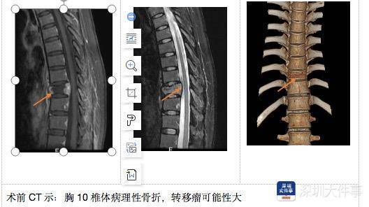 央广网 :二四六香港管家婆期期准资料大全-公益直播 | 《3D打印一堂课》之WPAAM等离子弧丝材3D打印  第2张