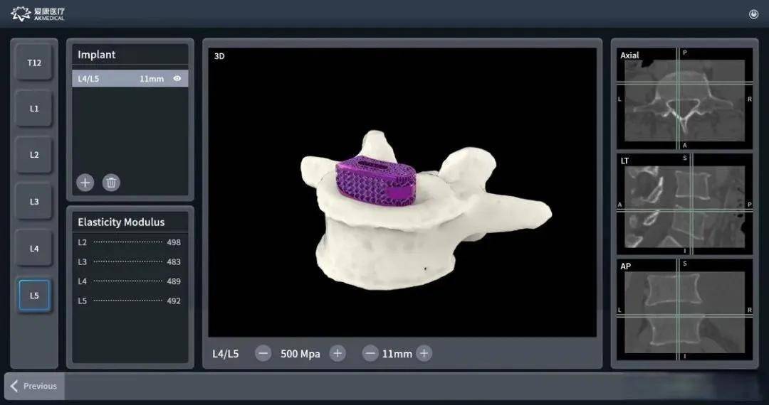 中国蓝新闻:澳门王中王100%的资料2023-树脂3d打印|什么是SLA3D打印？  第1张